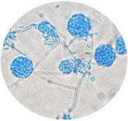 Acremonium as seen under a microscope