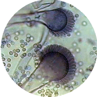 Mold pictures: Aspergillus fumigatus