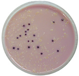 Coliforms (purple) growing on differential media.