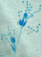 Paecilomyces marquandii, Conidiophores and spores 