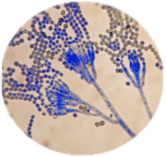 Penicillium chrysogenum as seen under a microscope