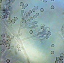 Scopulariopsis as seen under a microscope