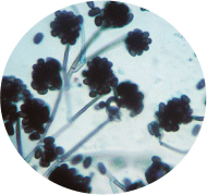 Black mold pictures: Stachybotrys