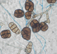 Ulocladium, Conidiophres and spores